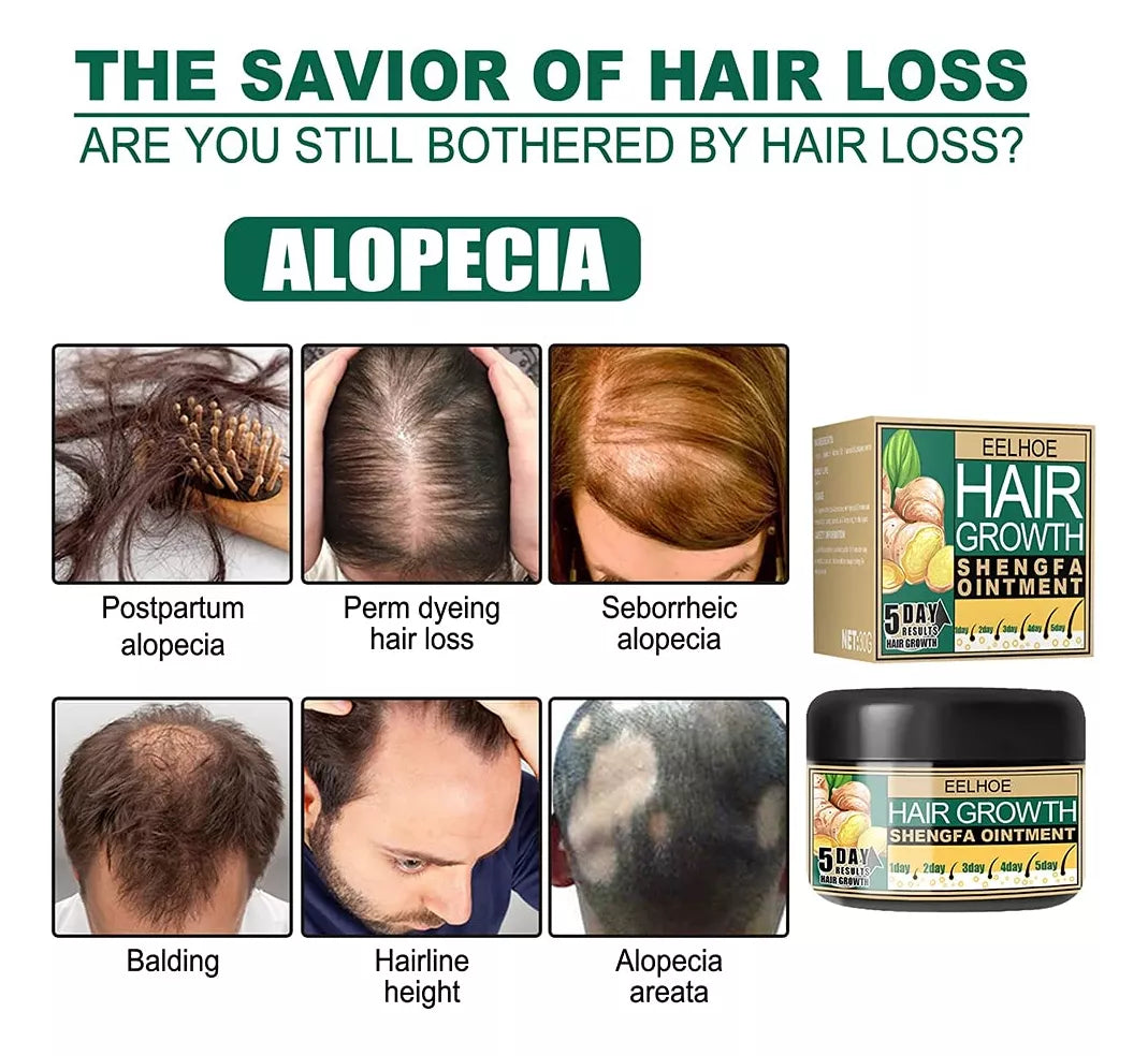 Jengibre Para Crecer El Pelo Eelhoe 🎁 ¡MUESTRA GRATIS!