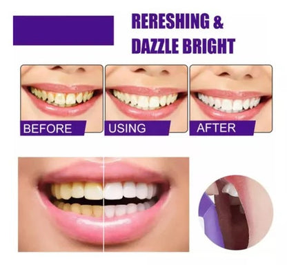 Blanqueador Dental Avanzado 🎁 ¡MUESTRA GRATIS!